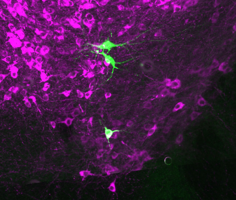 VTA neurons juxtacellularly labelled